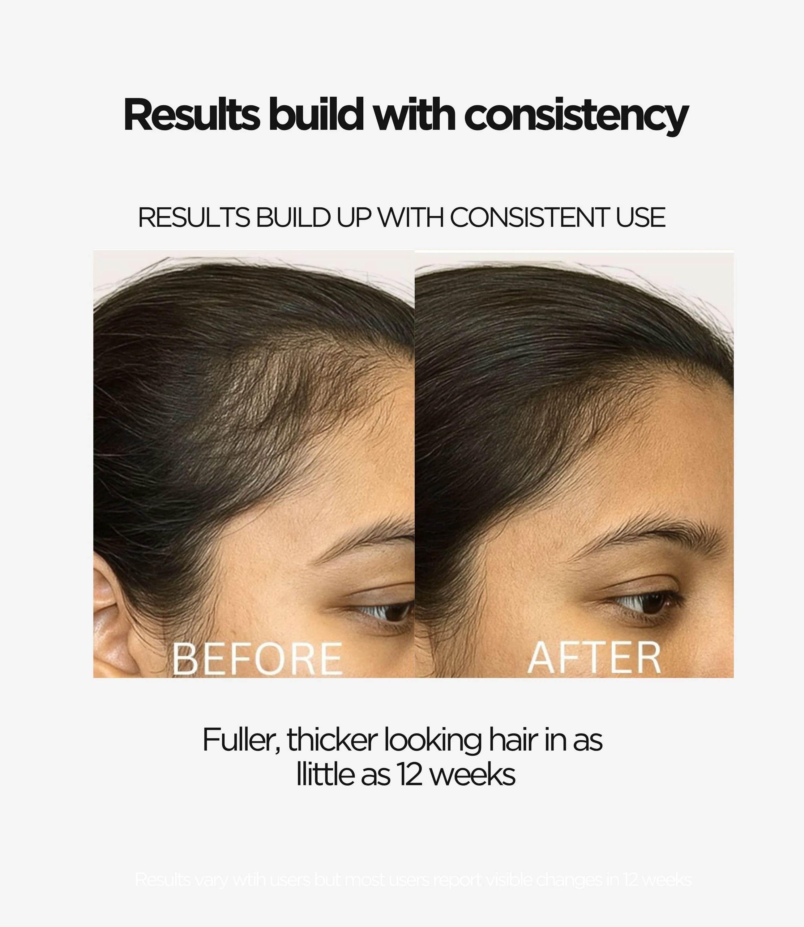 LED Hair Growth Brush – Stimulating Light & Scalp Revitalizer